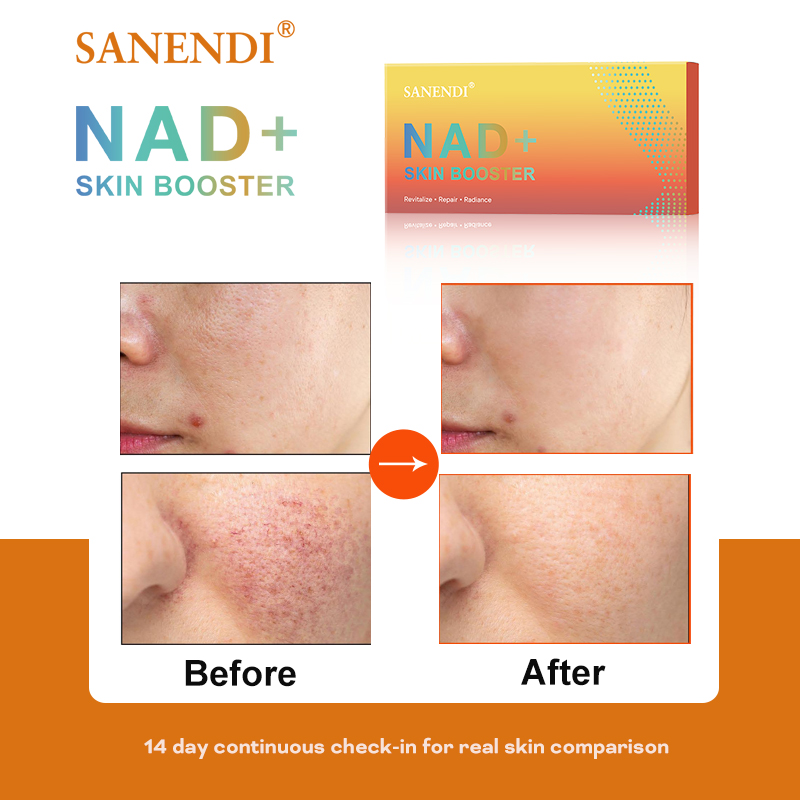 Sanendi NAD + corée produit de - Korean Skincare Routine avis et prix