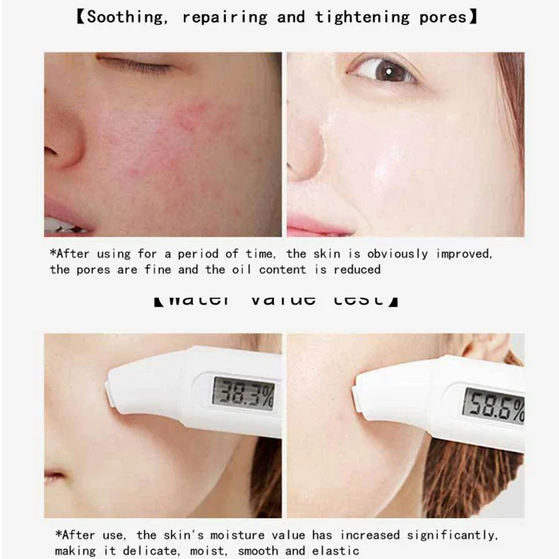 Centella – masques faciaux au  - Korean Skincare Routine avis et prix